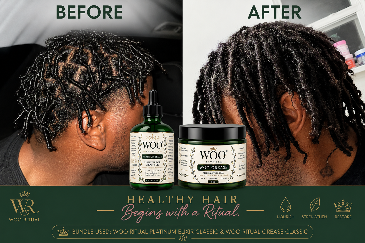 Before and after using WOO Ritual Platinum Elixir Hair Growth Oil — Classic.